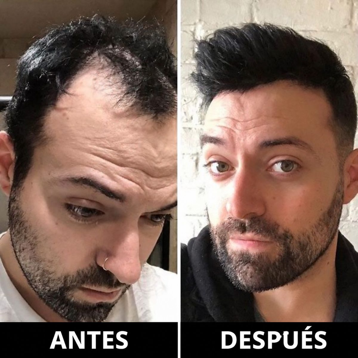 Depura® Sérum Regenerador Capilar